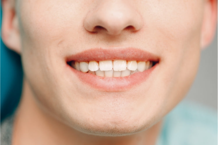 Why Small Straight Teeth Are - Rightly - The Global 'Dream' Combo