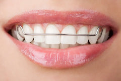 Clear Retainers vs. Metal Retainers: Which Is Best for You?