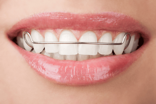 Close-up of person’s teeth, wearing metal retainers