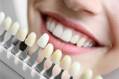 Get Pearly Whites in 2024: The Top Teeth Whitening Kits You Need to Try!