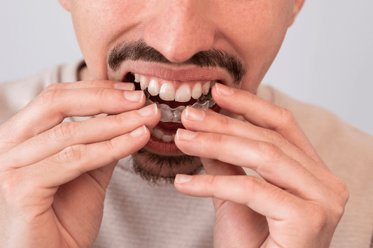 nvisible Aligners for Adults: Enhancing Your Smile, Discreetly